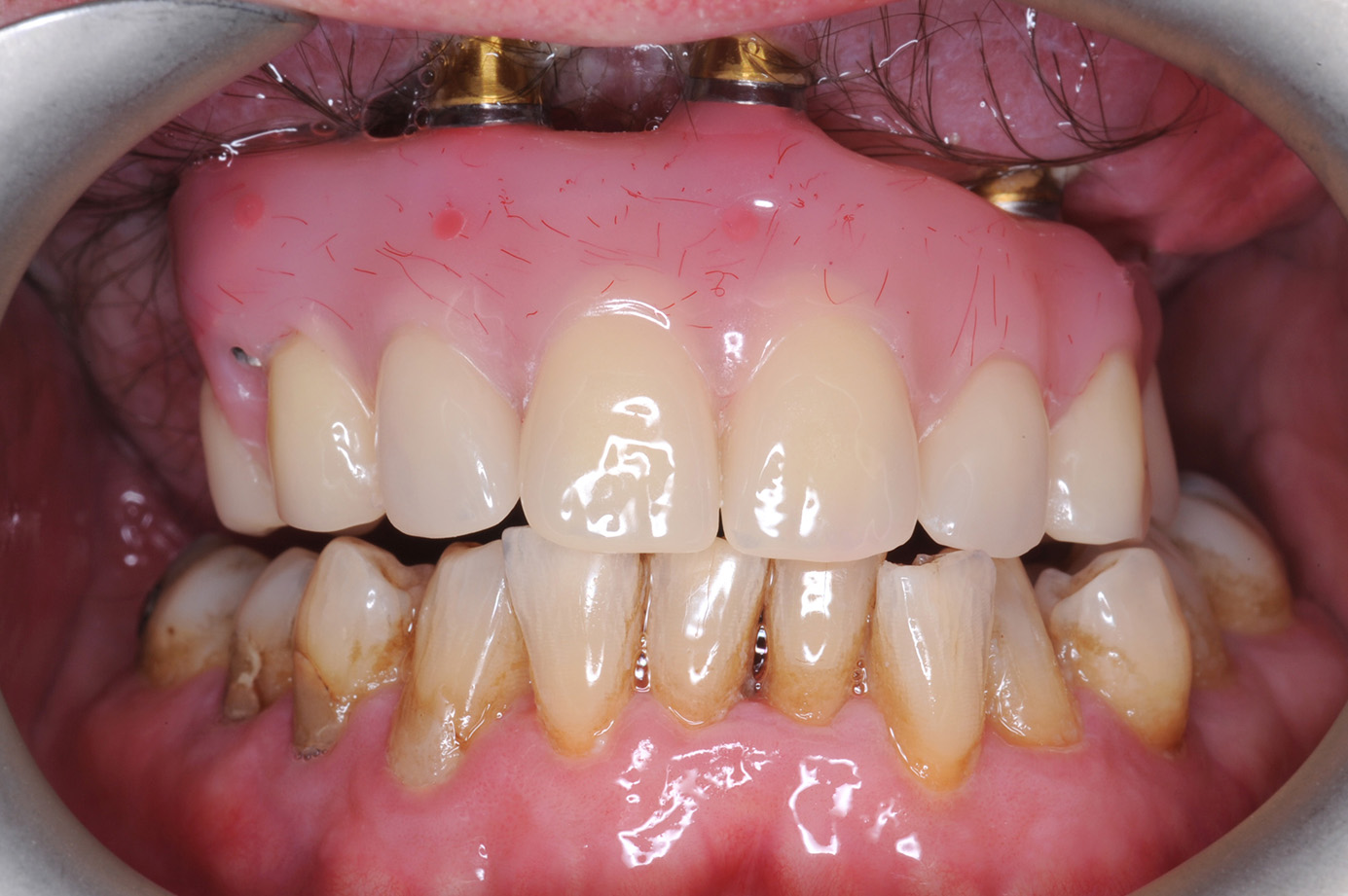 A photo of teeth