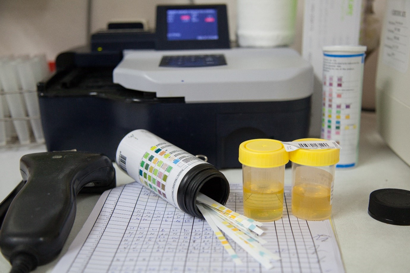 Urinalysis Machine photo