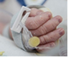 A photo depicting a baby hand with a cannula