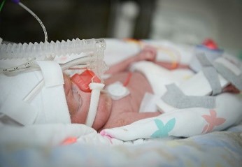 Photo of baby on NCPAP