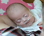 A photo of a baby using a nasal prong oxygen therapy