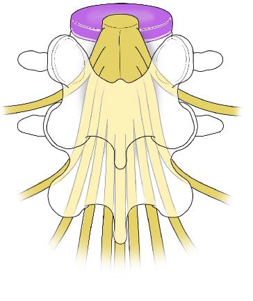 Normal anatomy
