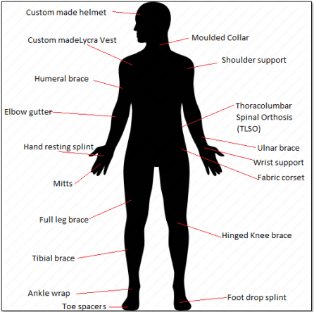 Examples of orthoses infographic